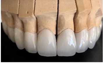 what-are-advantages-and-disadvantages-of-zirconium-crown