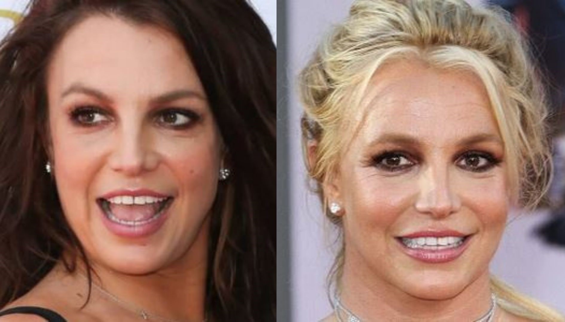 What happened to Britney Spears' teeth?