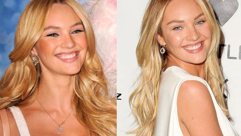 celebrities-with-veneers-Candice Swenapoel celebrities-with-veneers-Candice Swenapoel