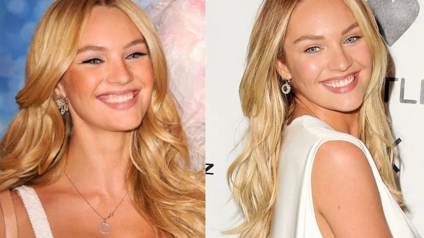 celebrities-with-veneers-Candice Swenapoel celebrities-with-veneers-Candice Swenapoel