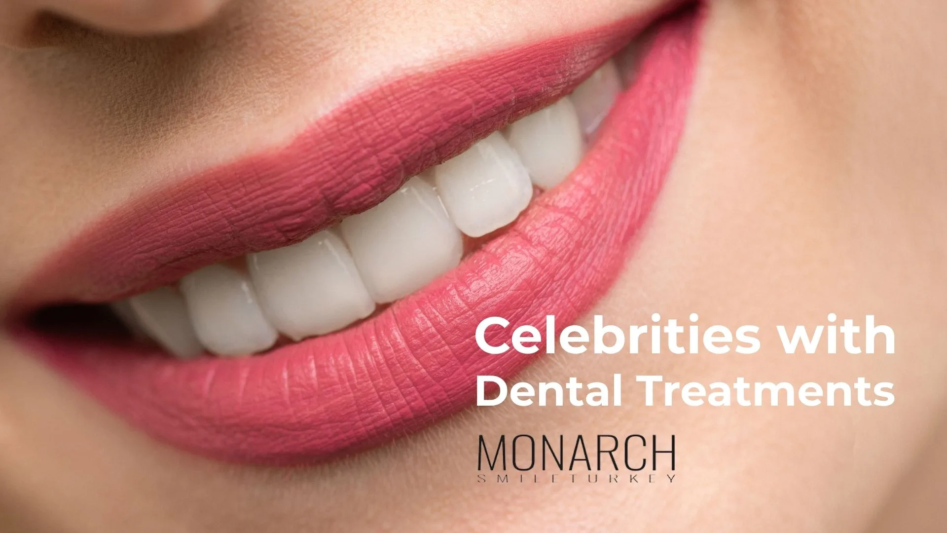  celebrities-with-dental-treatments 