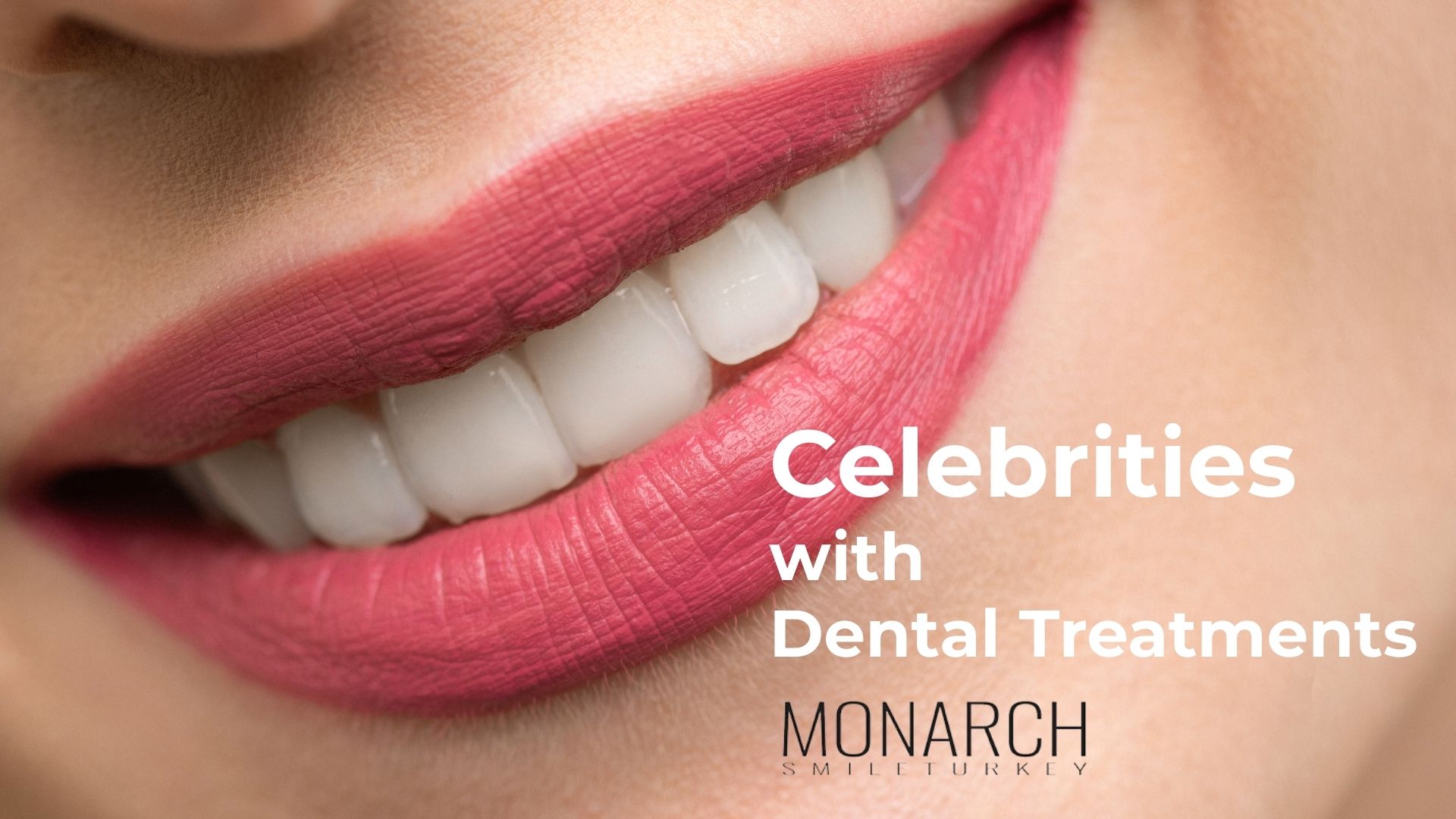 celebrities-with-dental-treatments