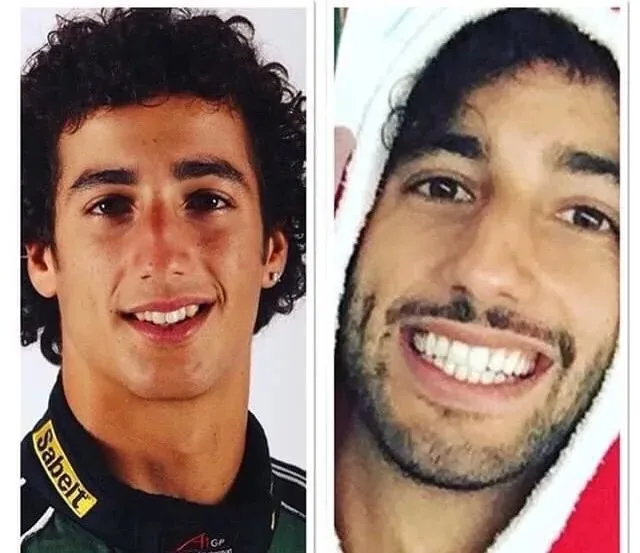celebrities-with-veneers-Daniel Ricciardo celebrities-with-veneers-Daniel Ricciardo