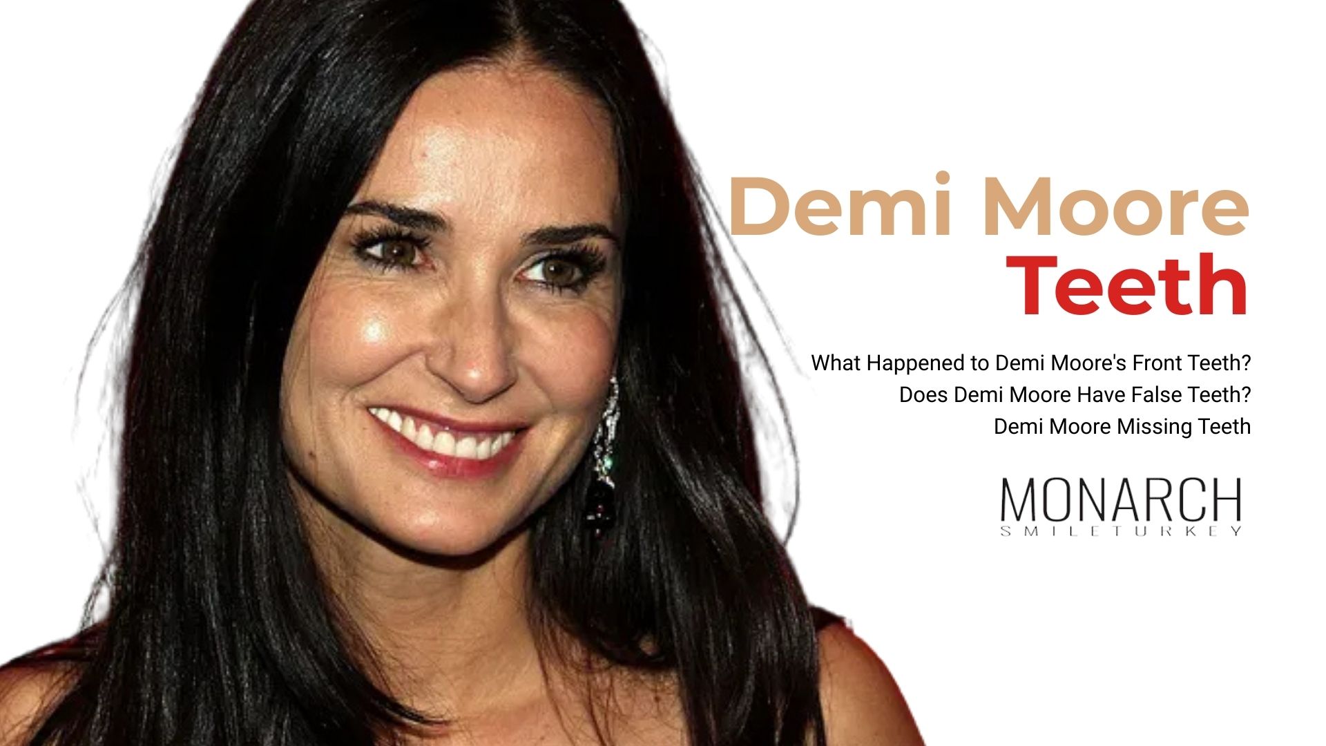  Demi Moore Teeth