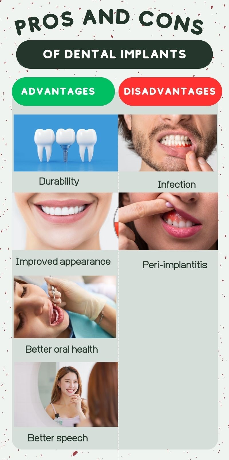 What are pros and cons of dental implants? in Turkey, Antalya