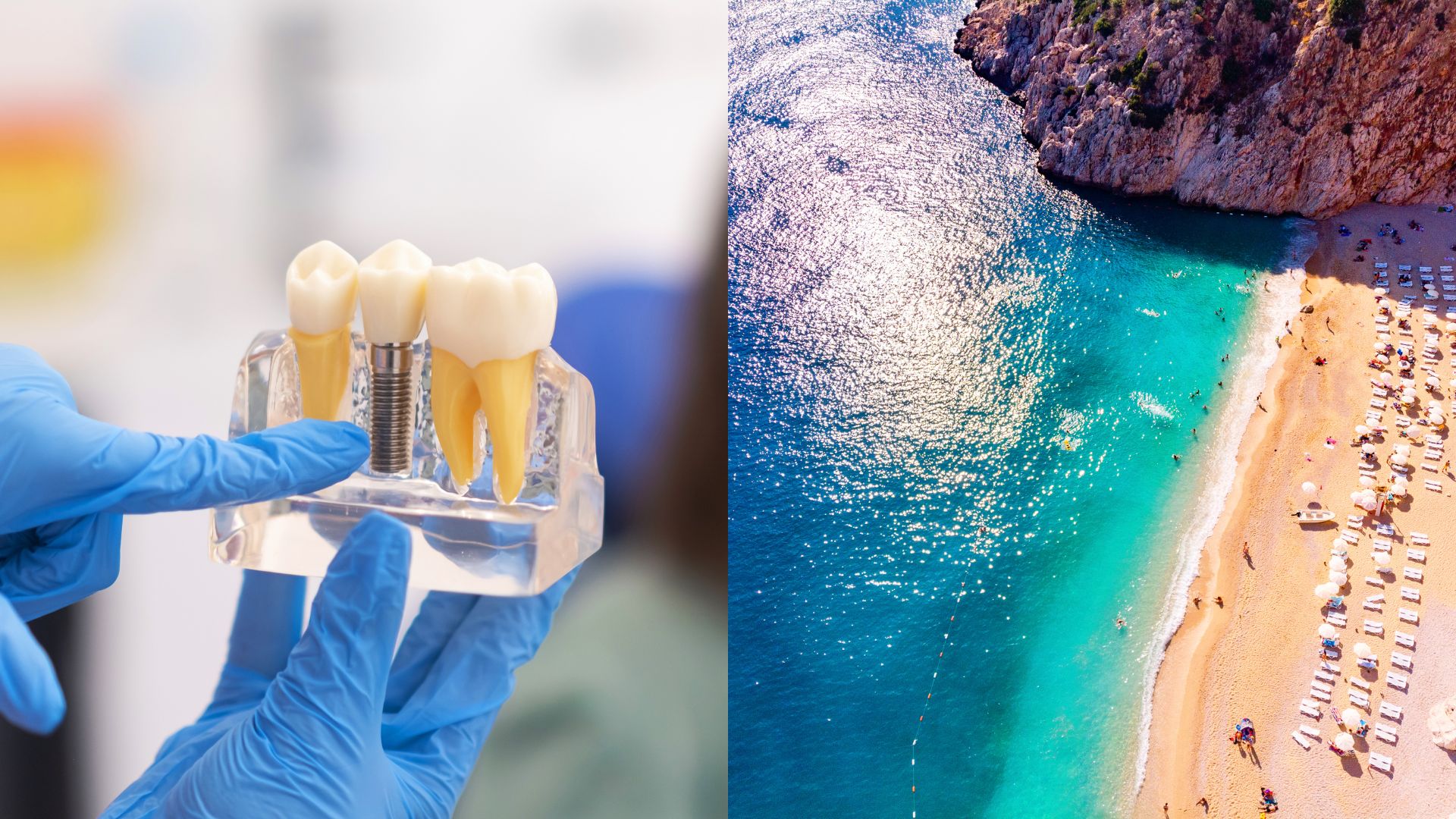 is-it-worth-going-to-turkey-for-dental-implants