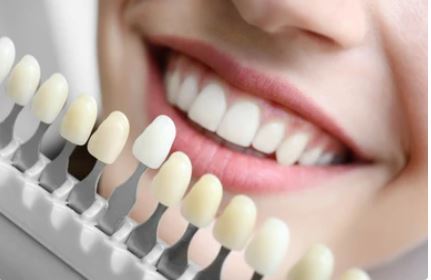 How to choose the right dental implant for your needs in Turkey
