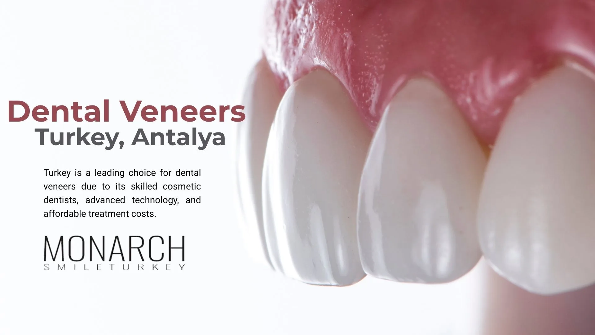 why-does-everyone-go-to-turkey-for-veneers