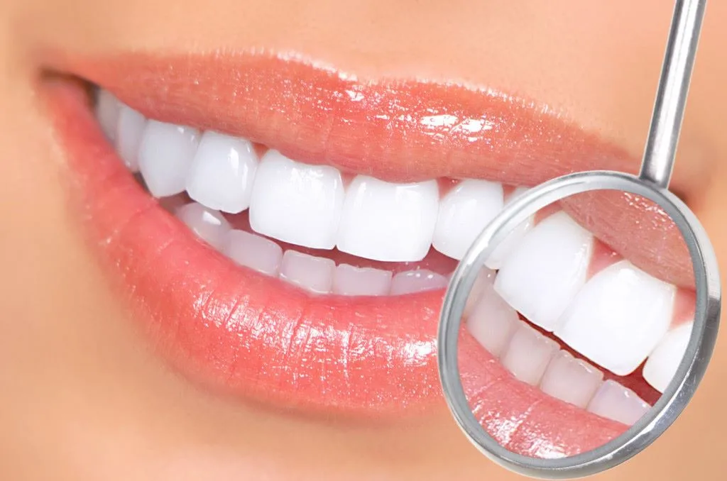 Full mouth restoration in Antalya, Turkey