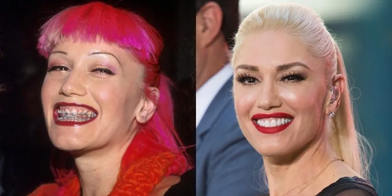 Gwen Stefani