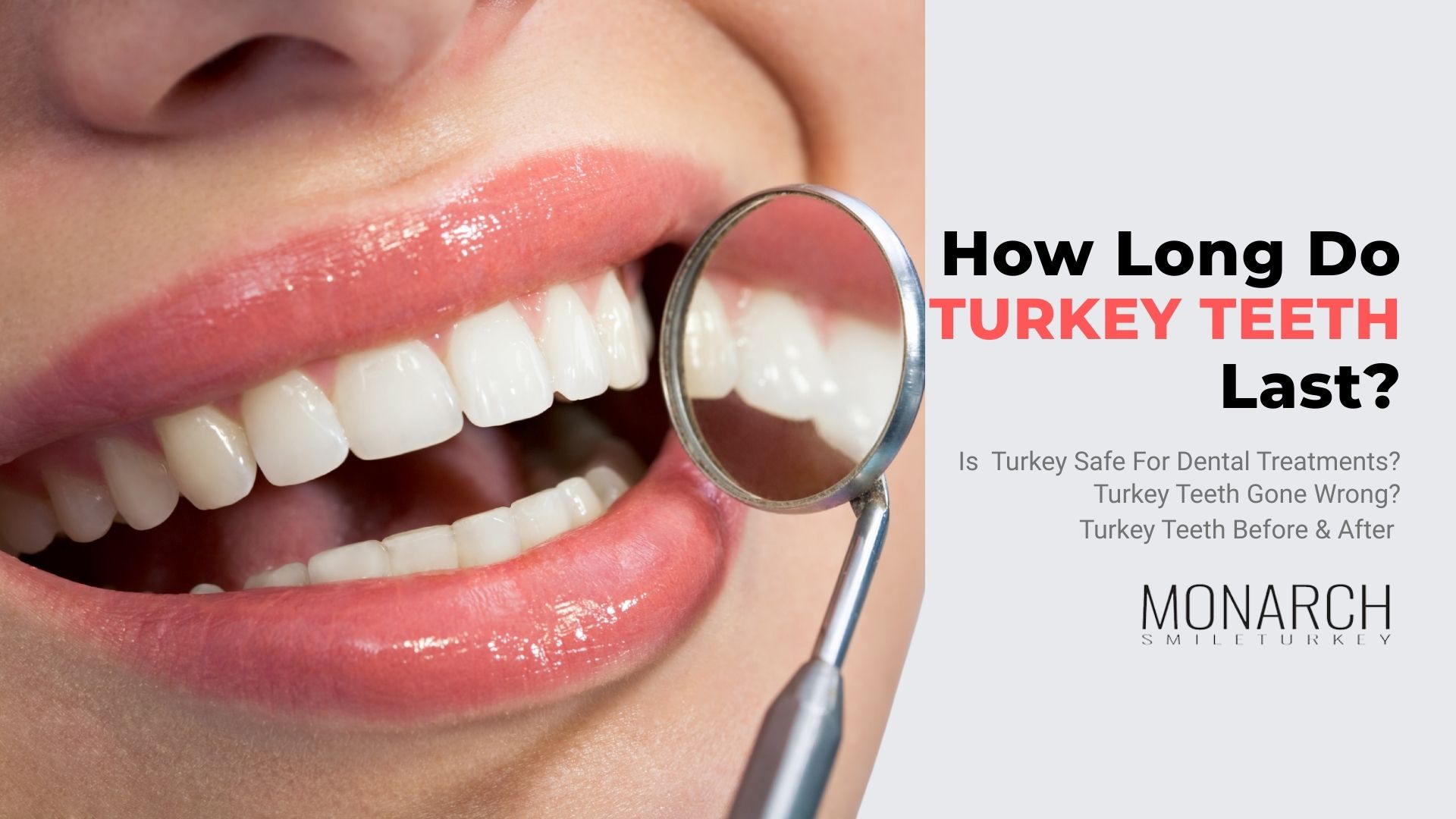 how-long-do-turkey-teeth-last