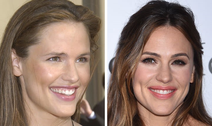 celebrities-with-veneers-Jennifer Garner celebrities-with-veneers-Jennifer Garner