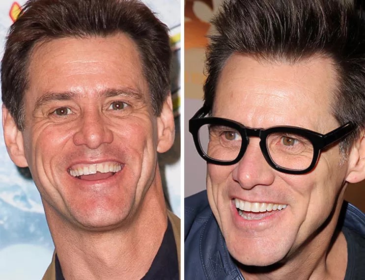 celebrities-with-veneers-Jim Carrey celebrities-with-veneers-Jim Carrey