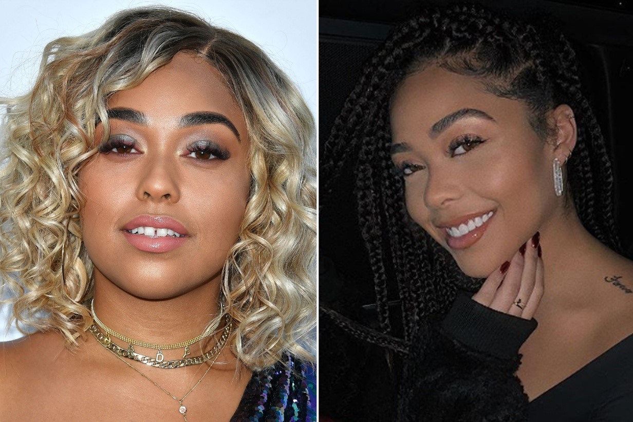 celebrities-with-veneers-Jordyn Woods celebrities-with-veneers-Jordyn Woods