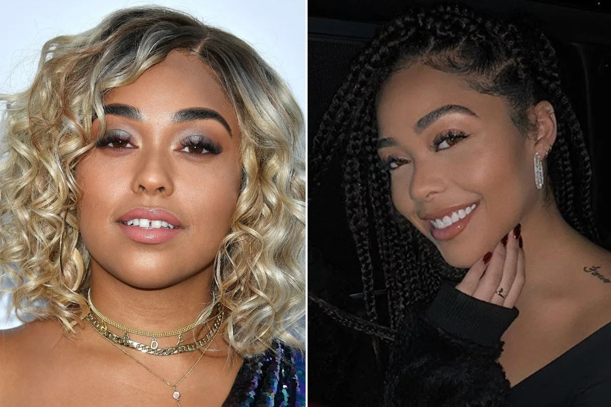 celebrities-with-veneers-Jordyn Woods celebrities-with-veneers-Jordyn Woods