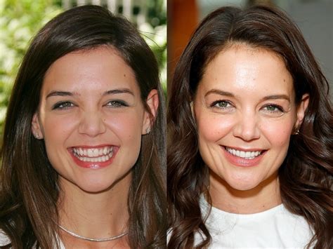 celebrities-with-veneers-Katie Holmes celebrities-with-veneers-Katie Holmes