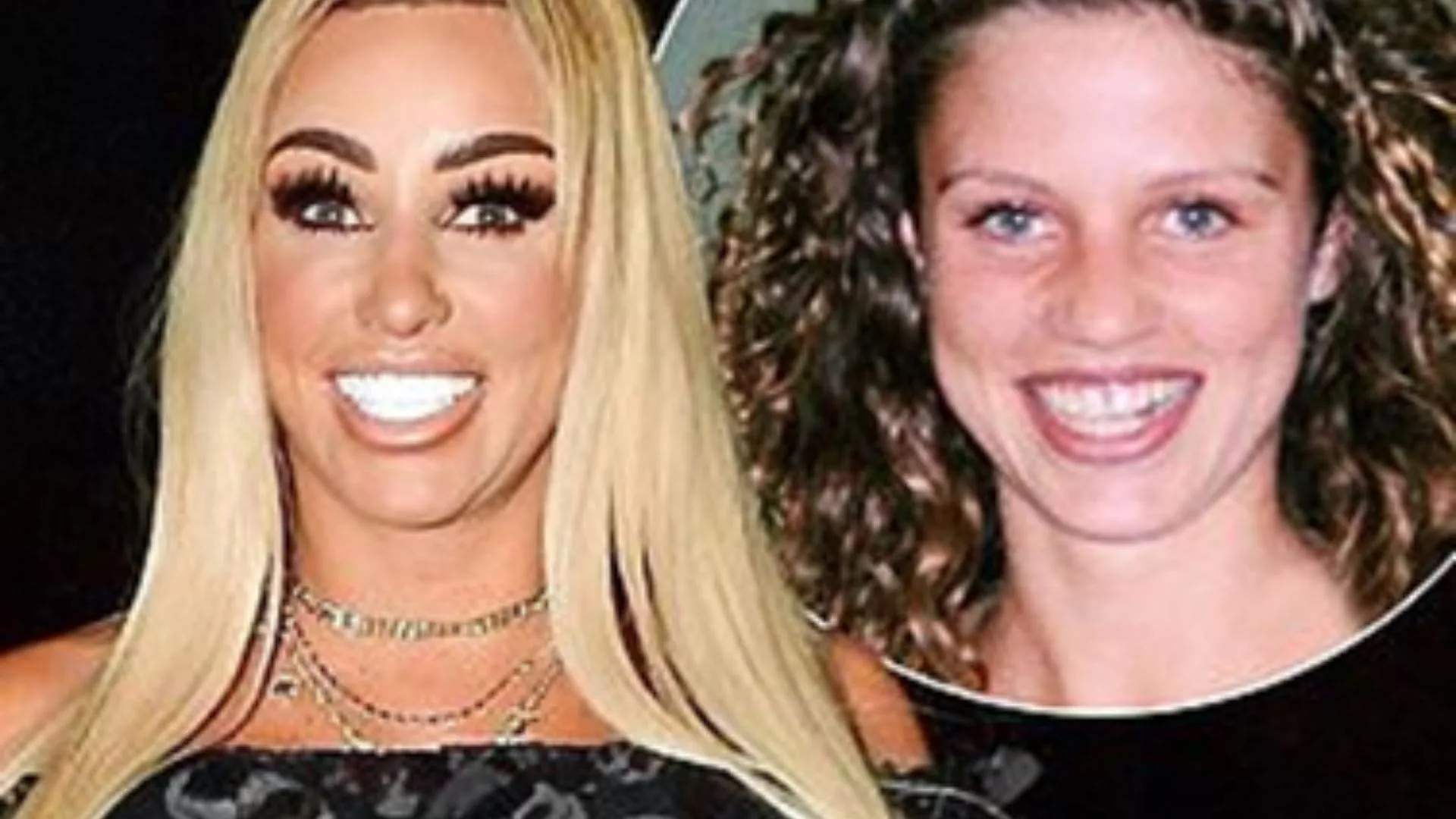 Katie Price's teeth transformation Katie Price's teeth transformation