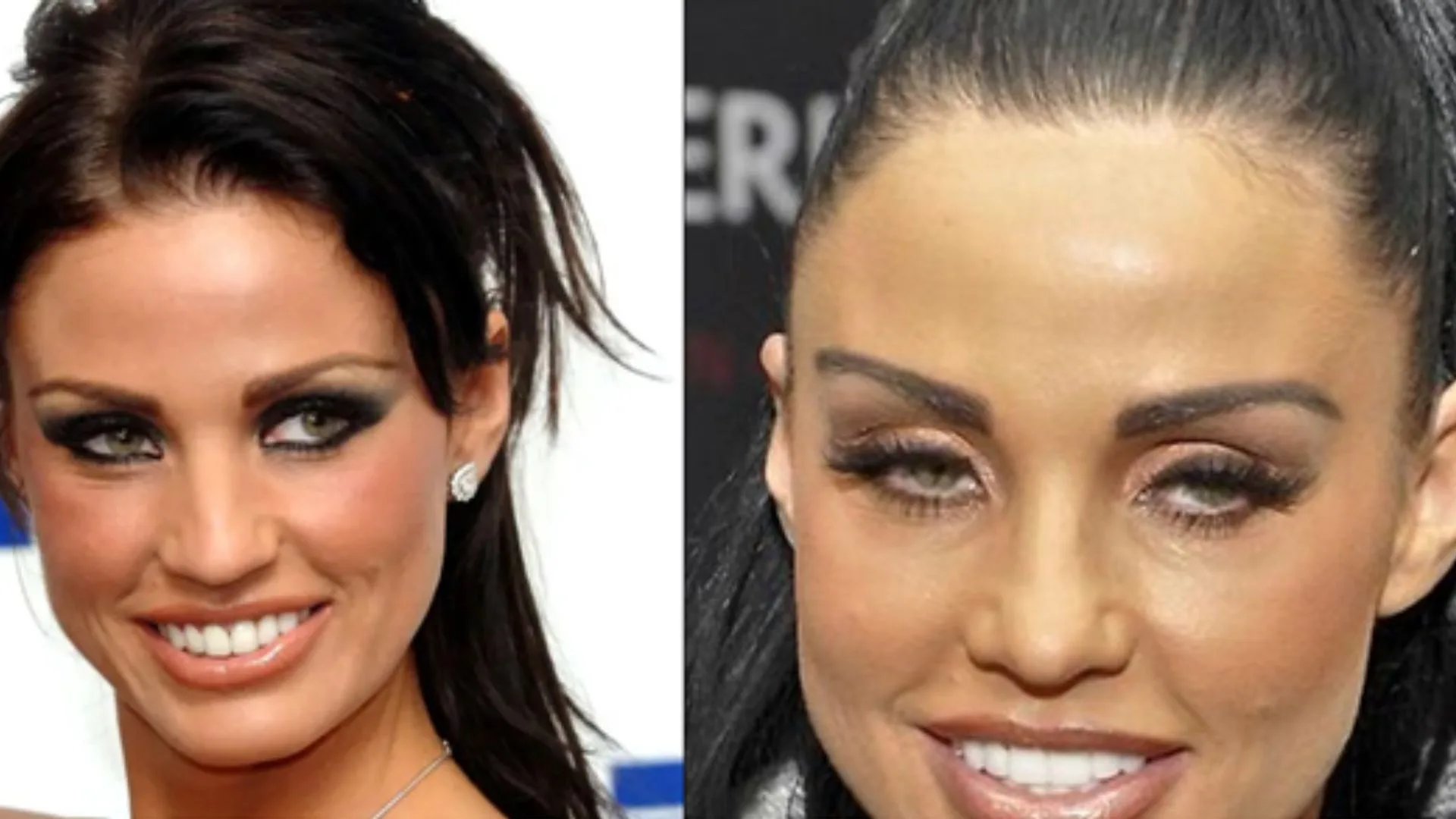 Katie Price 2007 teeth transformation Katie Price 2007 teeth transformation