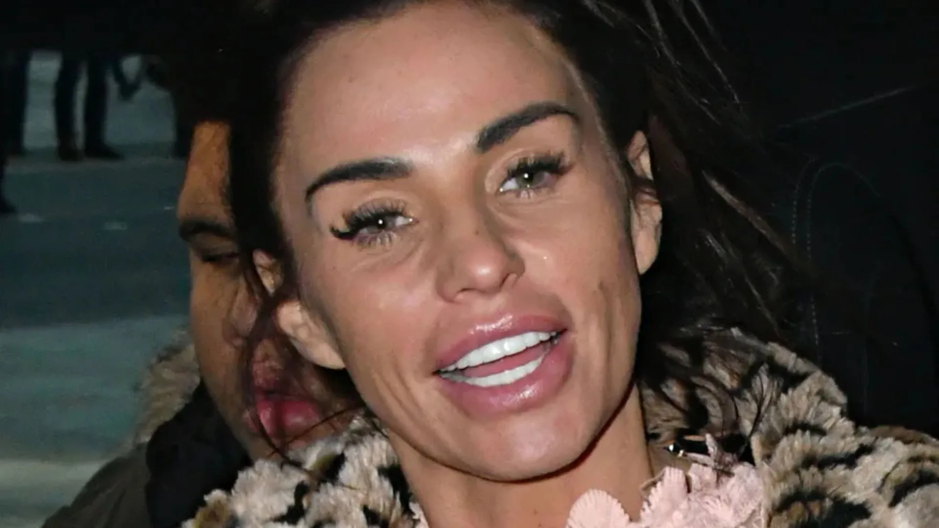What did Katie Price have done to her teeth? What did Katie Price have done to her teeth?