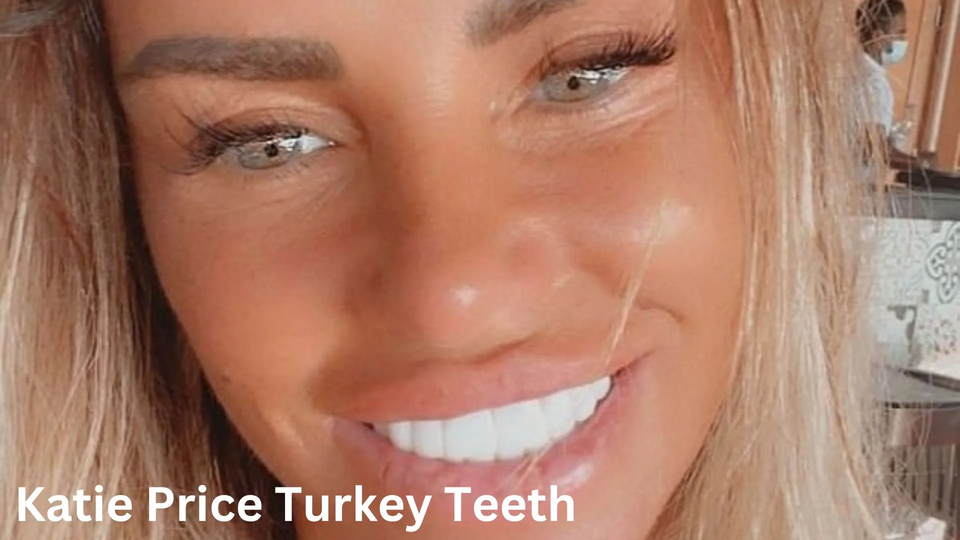 katie-price-teeth