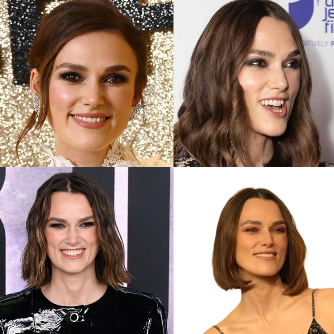 Keira Knightley's Smile Before and After