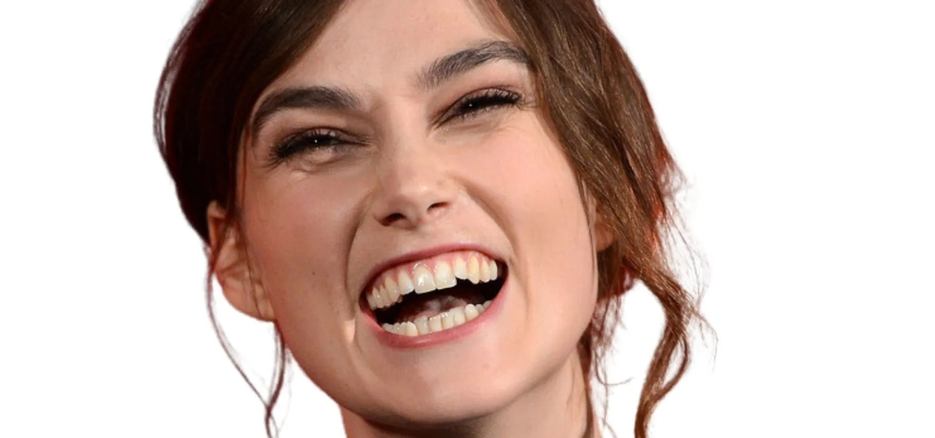  Keira Knightley's crooked teeth