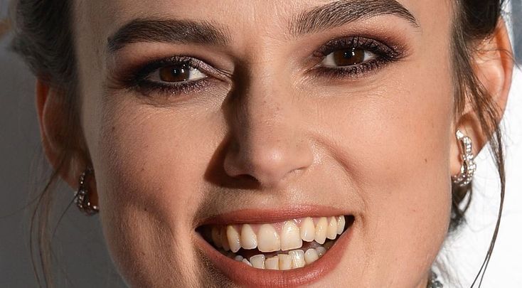 Keira Knightley Teeth before Keira Knightley Teeth before