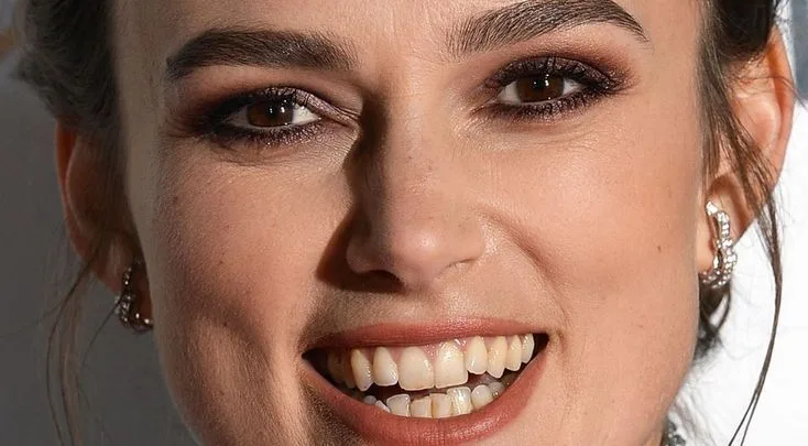  Keira Knightley Teeth before