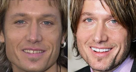 Keith Urban  
