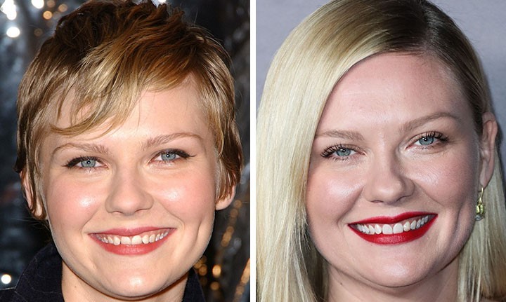 celebrities-with-veneers-Kirsten Dunst celebrities-with-veneers-Kirsten Dunst