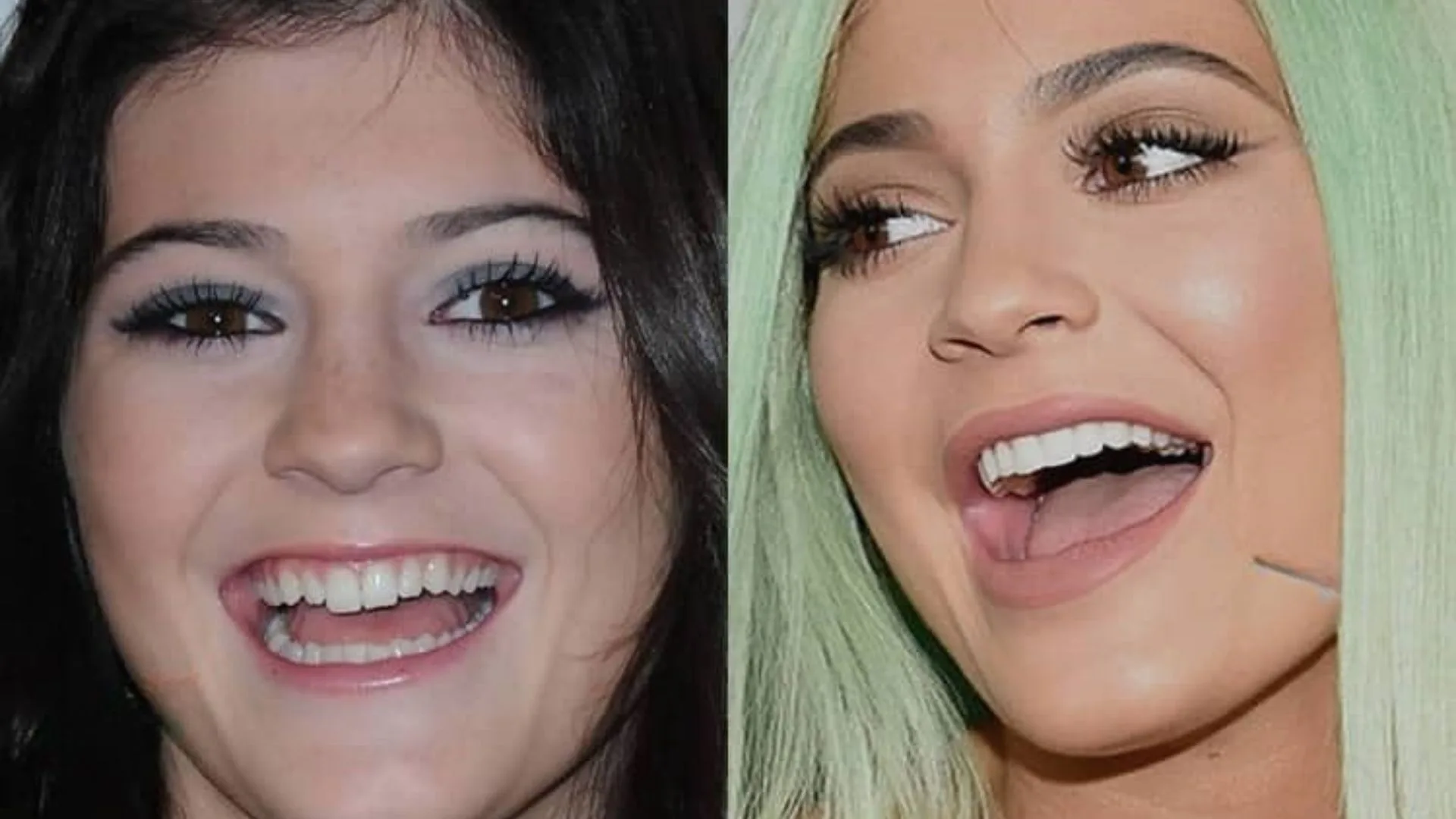 Kylie Jenner