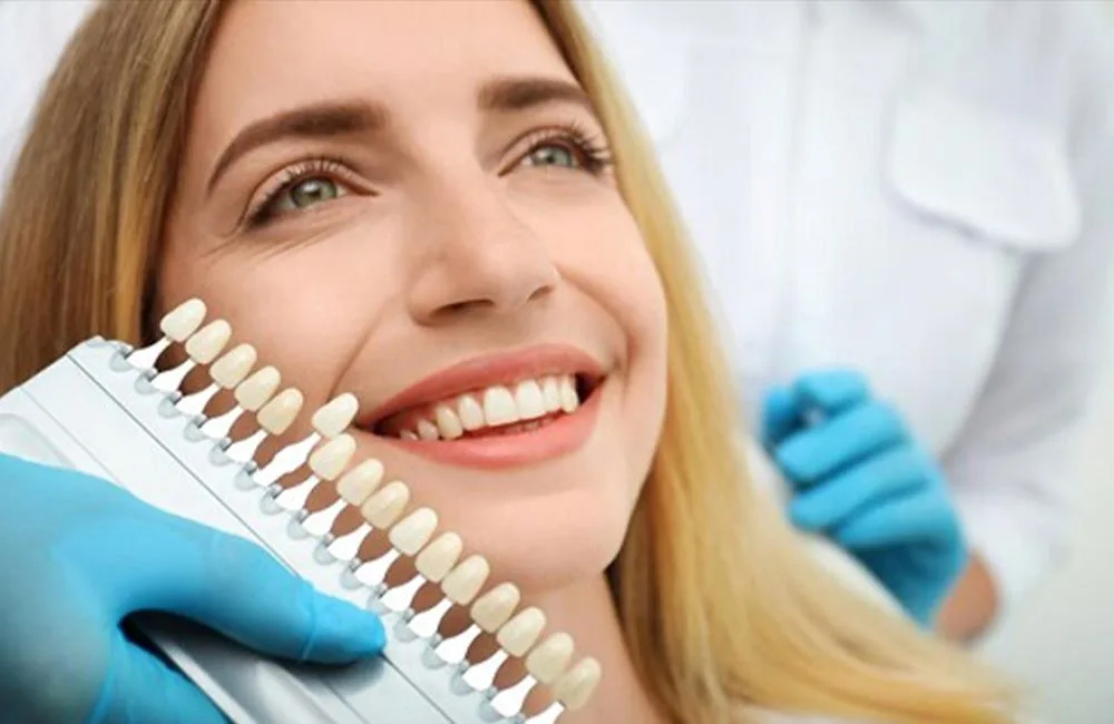 Laminate Veneers Teeth in Turkey