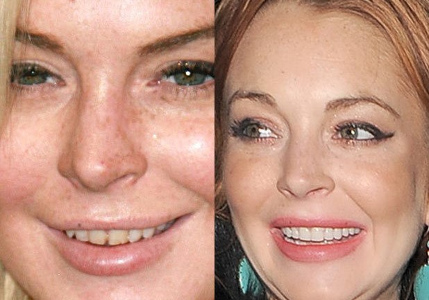 lindsay-lohan