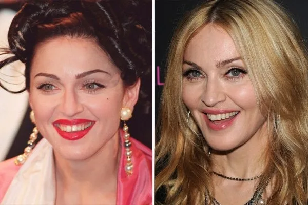 Madonna 
