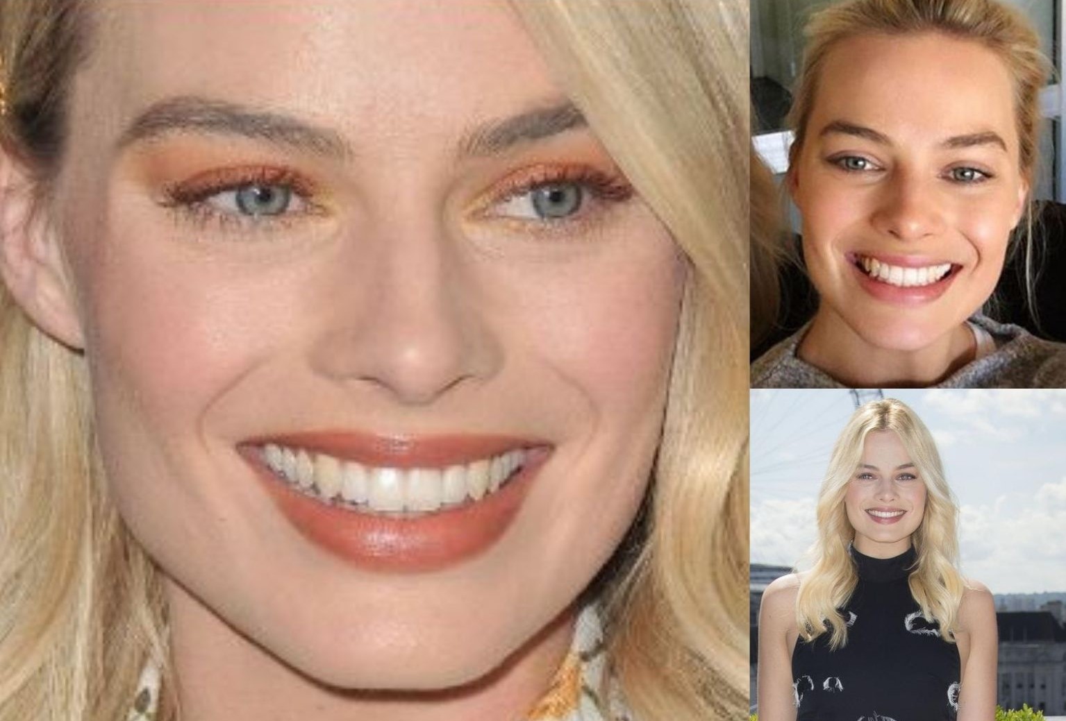 margot-robbie-teeth-before-after margot-robbie-teeth-before-after-1