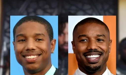 celebrities-with-veneers-Michael B. Jordan celebrities-with-veneers-Michael B. Jordan