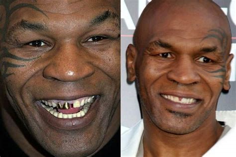Mike Tyson 