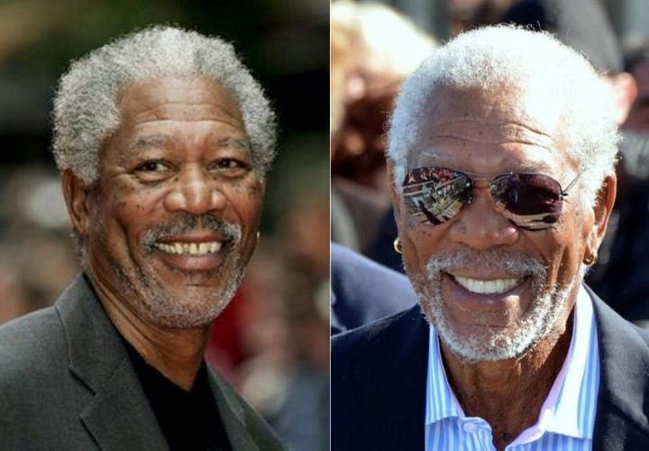 celebrities-with-veneers-Morgan Freeman celebrities-with-veneers-Morgan Freeman