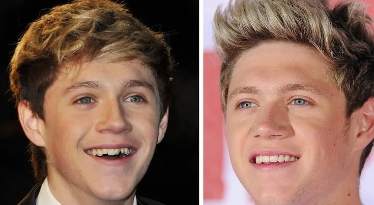 Niall Horan