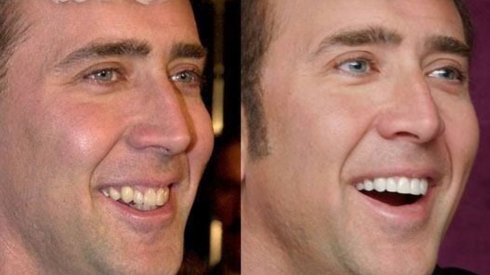 Nicolas Cage 