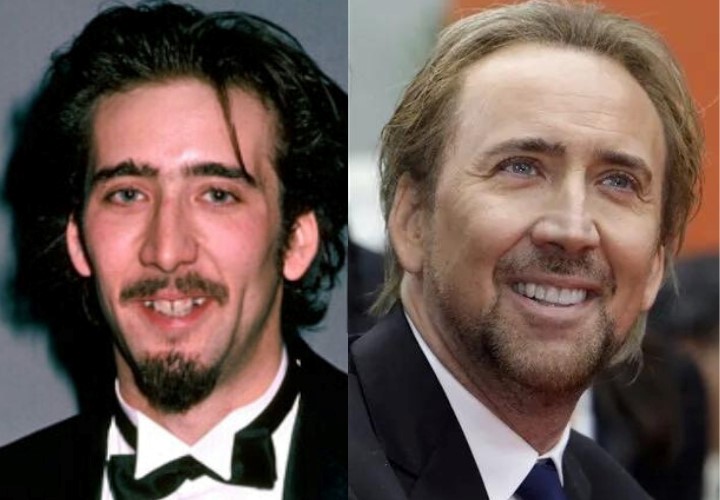 celebrities-with-veneers-nicolas-cage celebrities-with-veneers-nicolas-cage