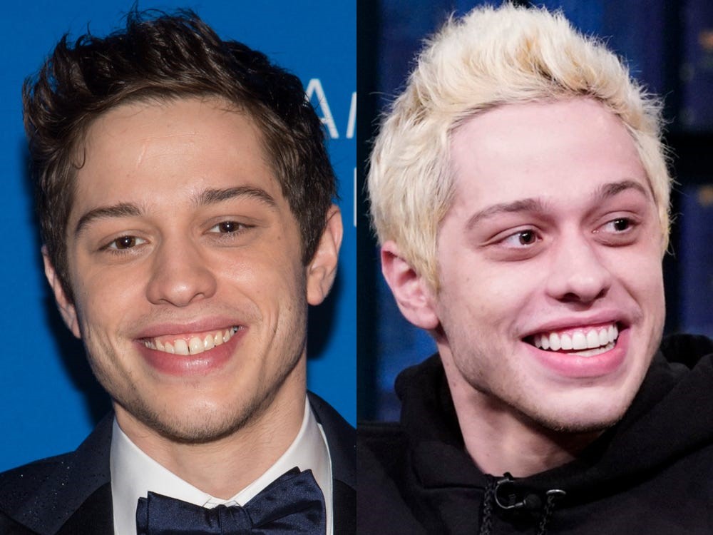 celebrities-with-veneers-Pete Davidson celebrities-with-veneers-Pete Davidson