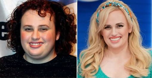 celebrities-with-veneers-Rebel Wilson celebrities-with-veneers-Rebel Wilson