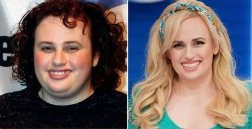 celebrities-with-veneers-Rebel Wilson celebrities-with-veneers-Rebel Wilson