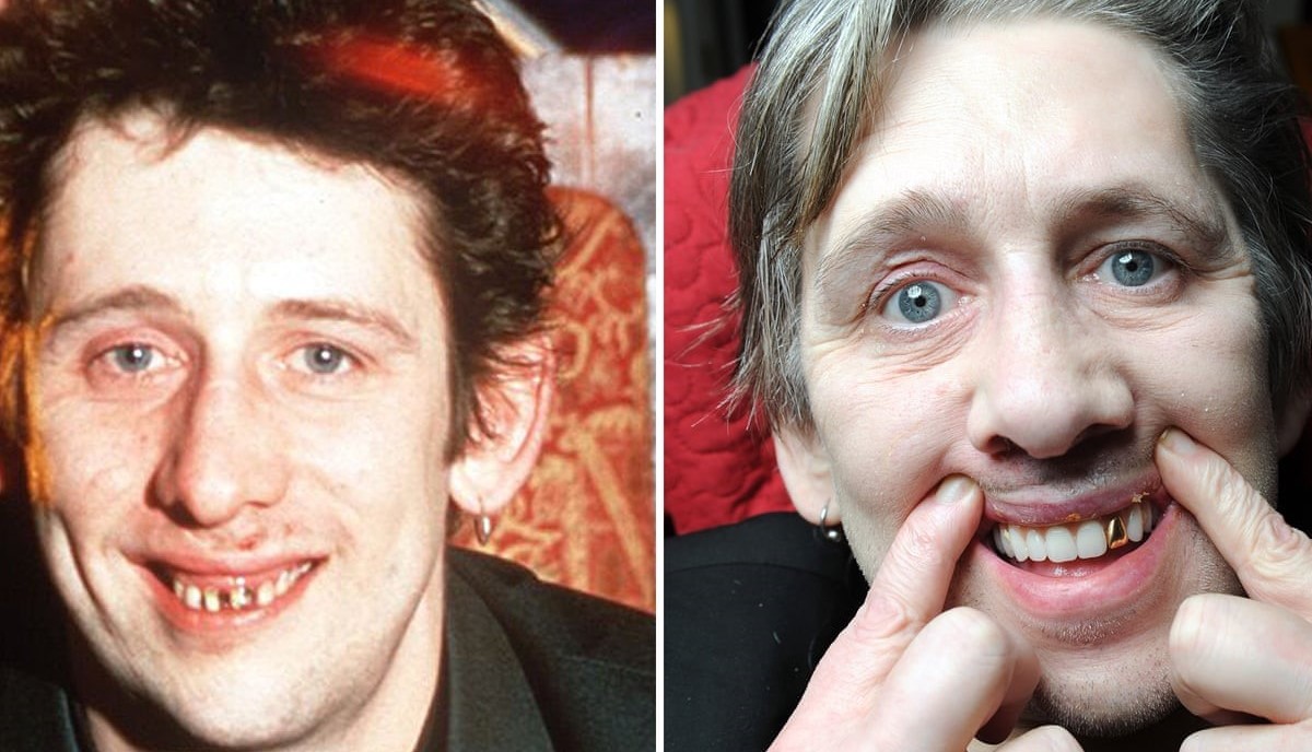 Shane MacGowan 