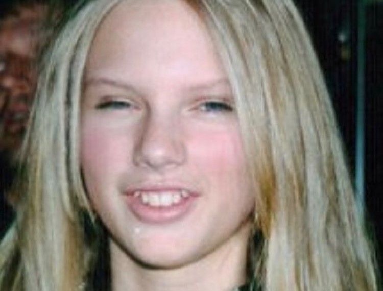  Taylor Swift's teeth as a teenager