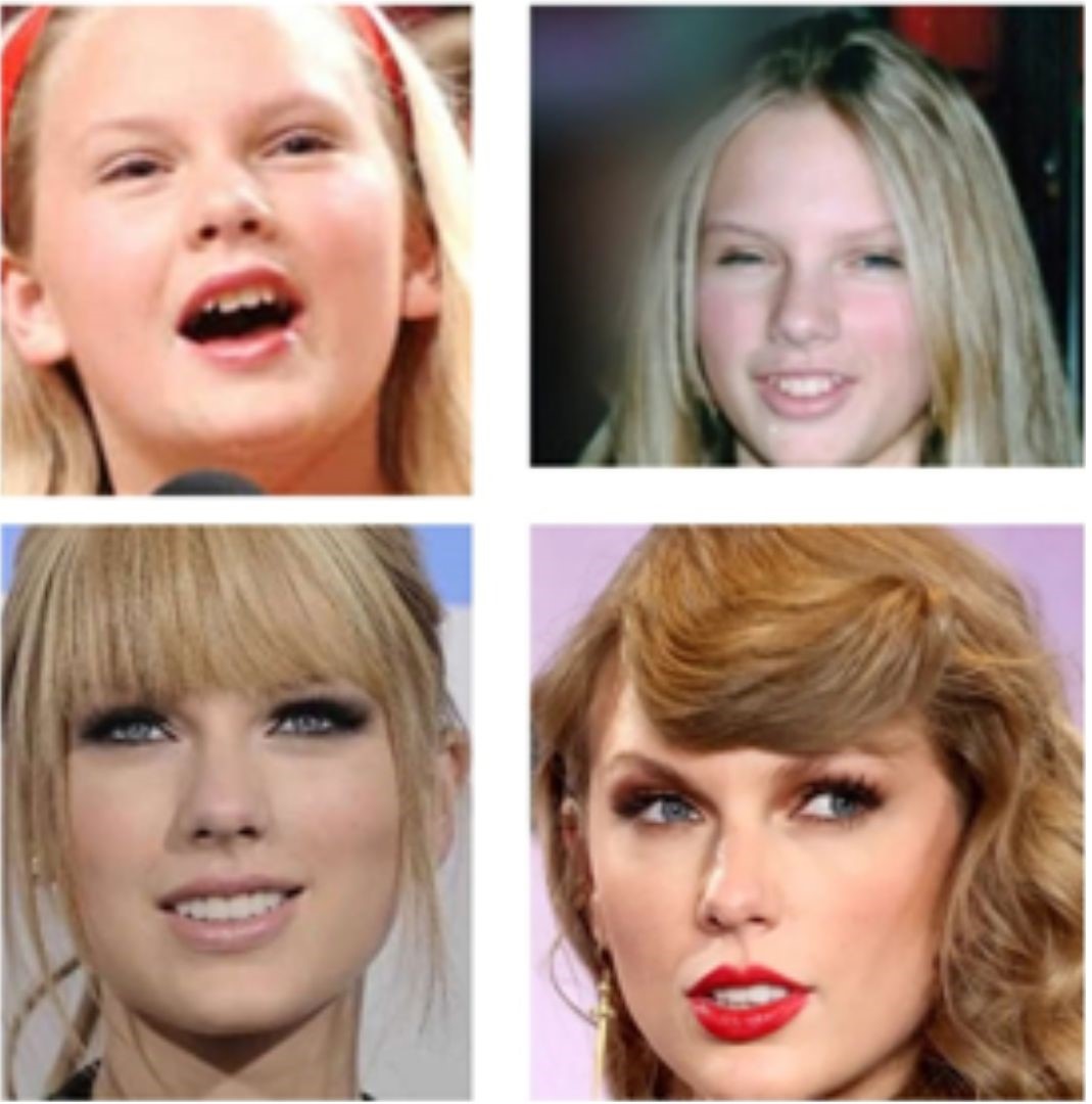  Taylor Swift's teeth as a teenager