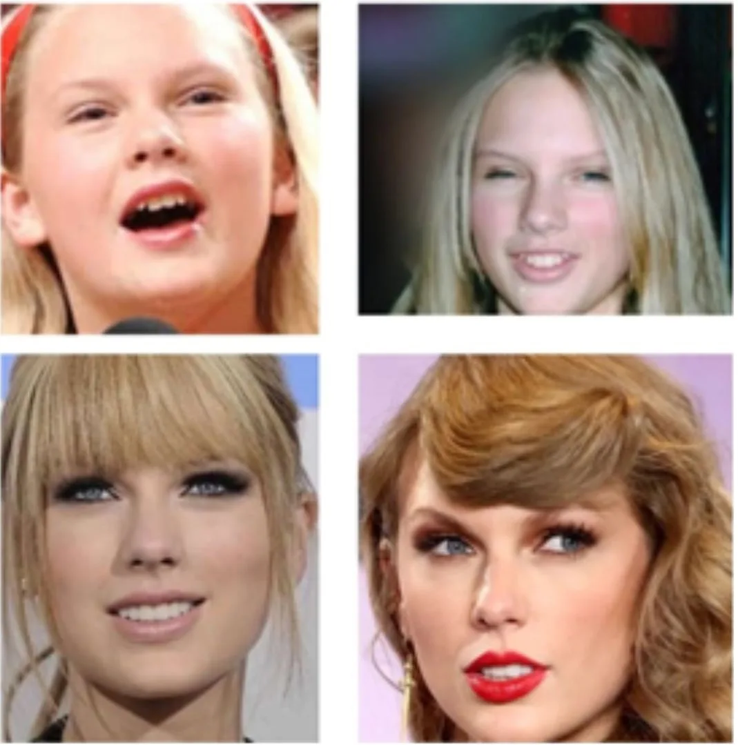 Taylor Swift's teeth as a teenager Taylor Swift's teeth as a teenager