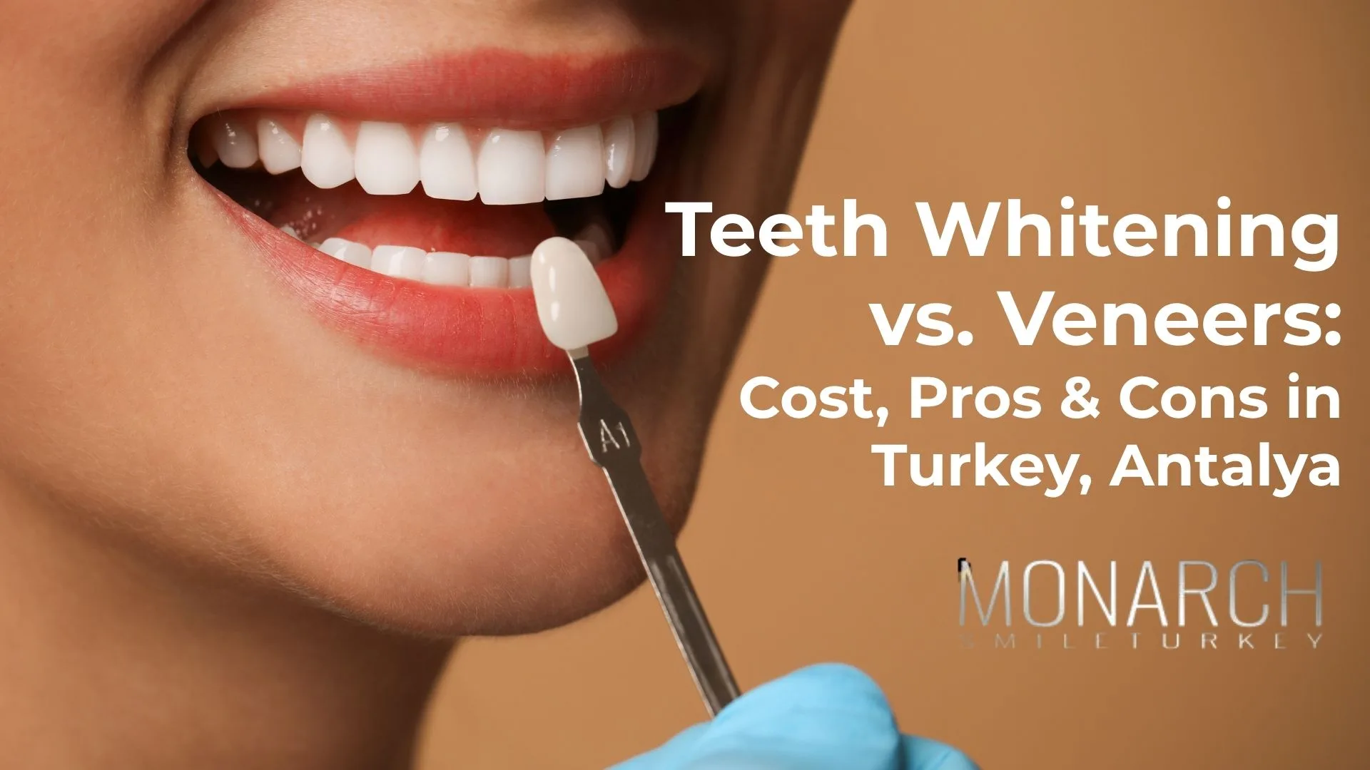 teeth-whitening-vs-veneers-turkey-antalya