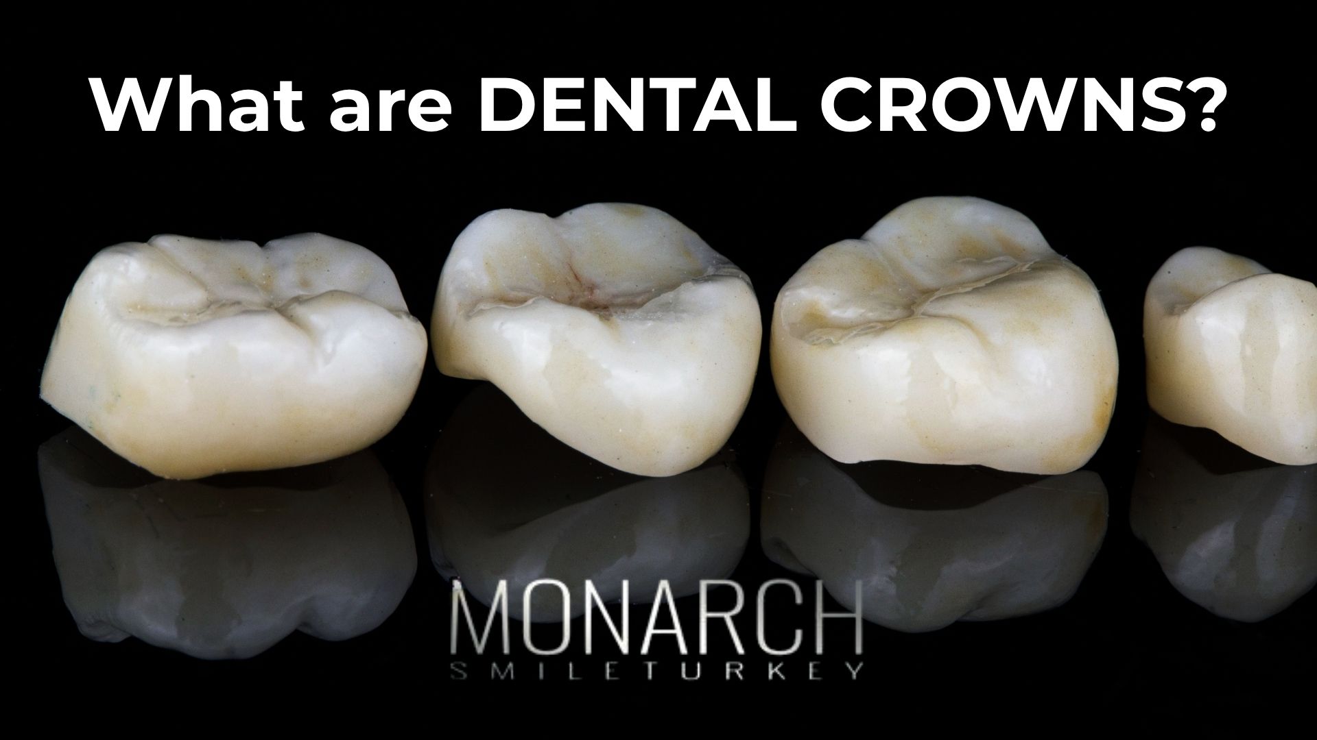 What are Crowns for Teeth?
